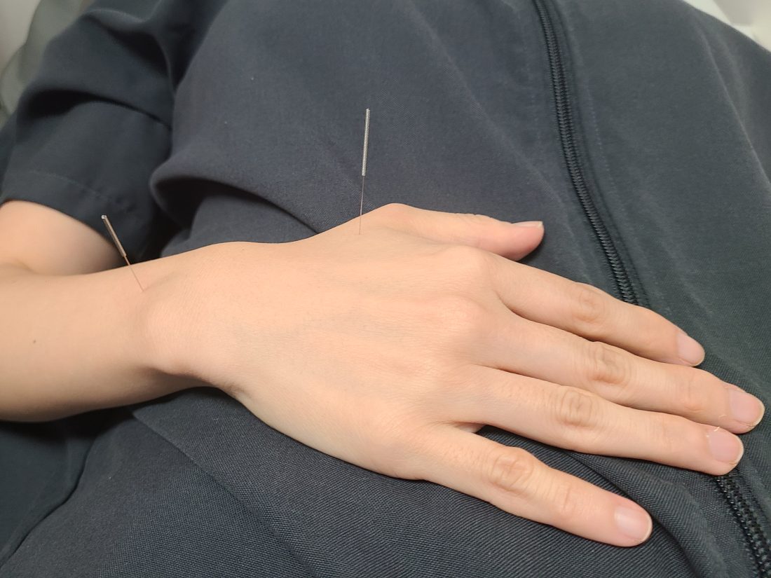 배에 침을 놓고 손을 올린 채 누워 있는 장면