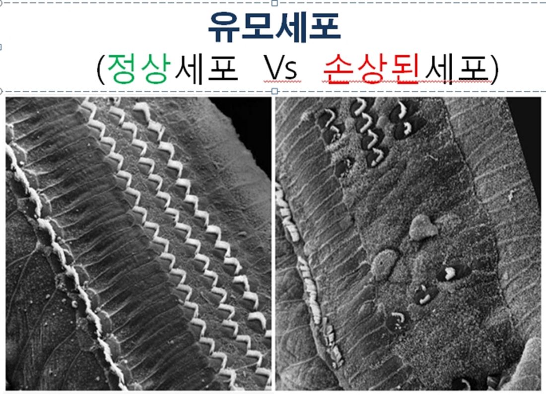 정상 유모세포와 손상된 유모세포를 비교한 전자현미경 사진
