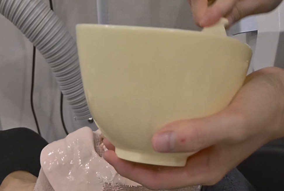 점 관련 시술 장면