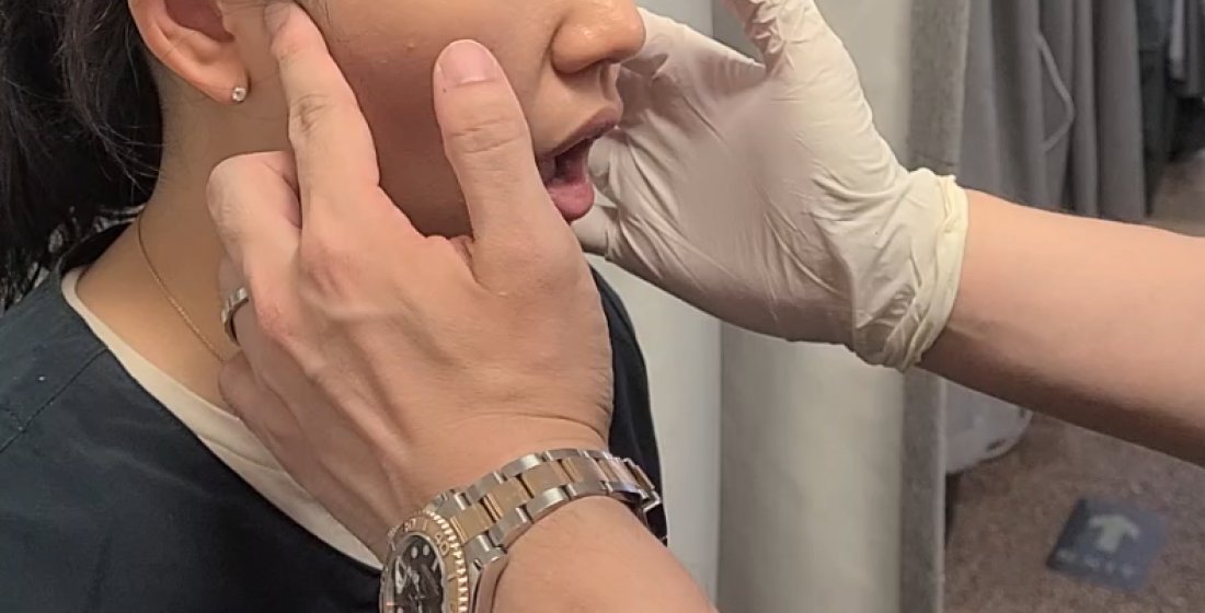 장갑 낀 손으로 턱관절 주변을 잡고 움직이는 턱관절 교정 장면
