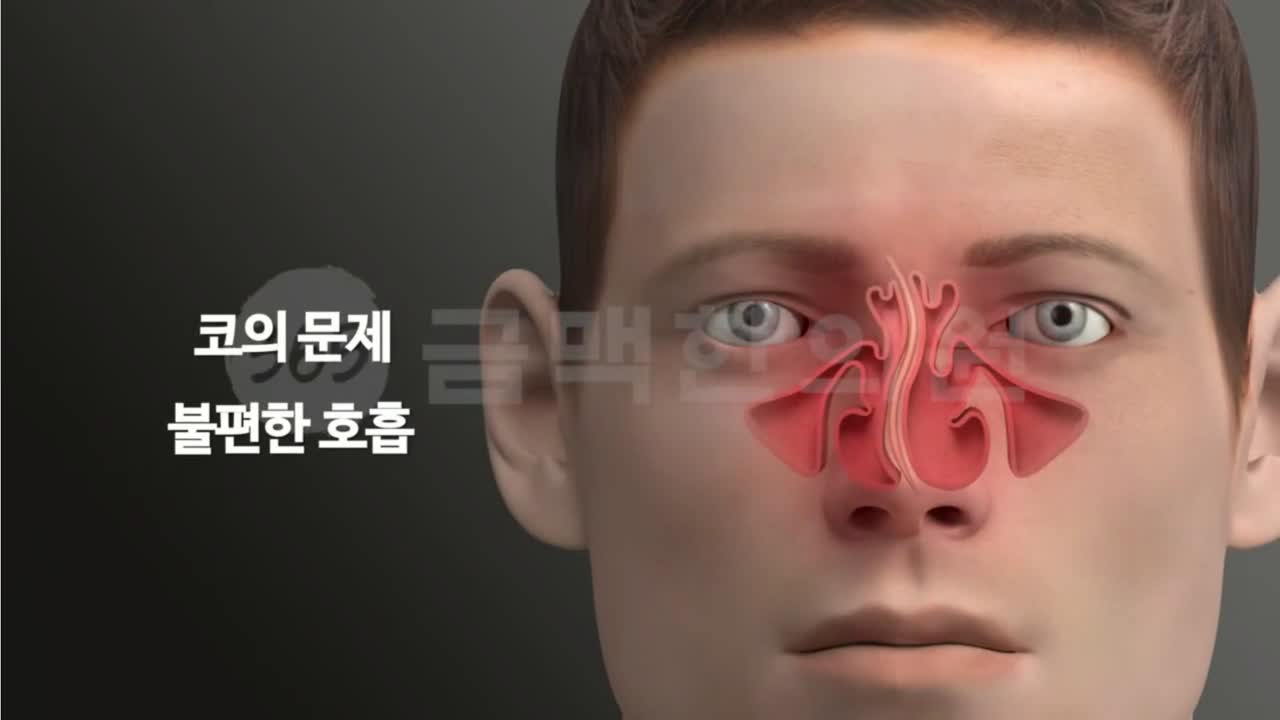 비염·코 클리닉 진료 장면