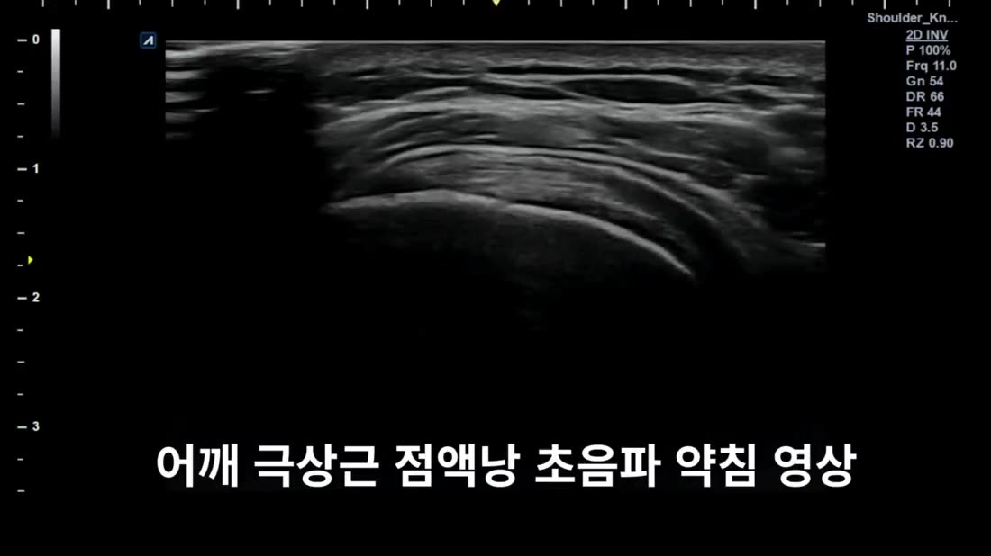 목·어깨 클리닉 진료 장면